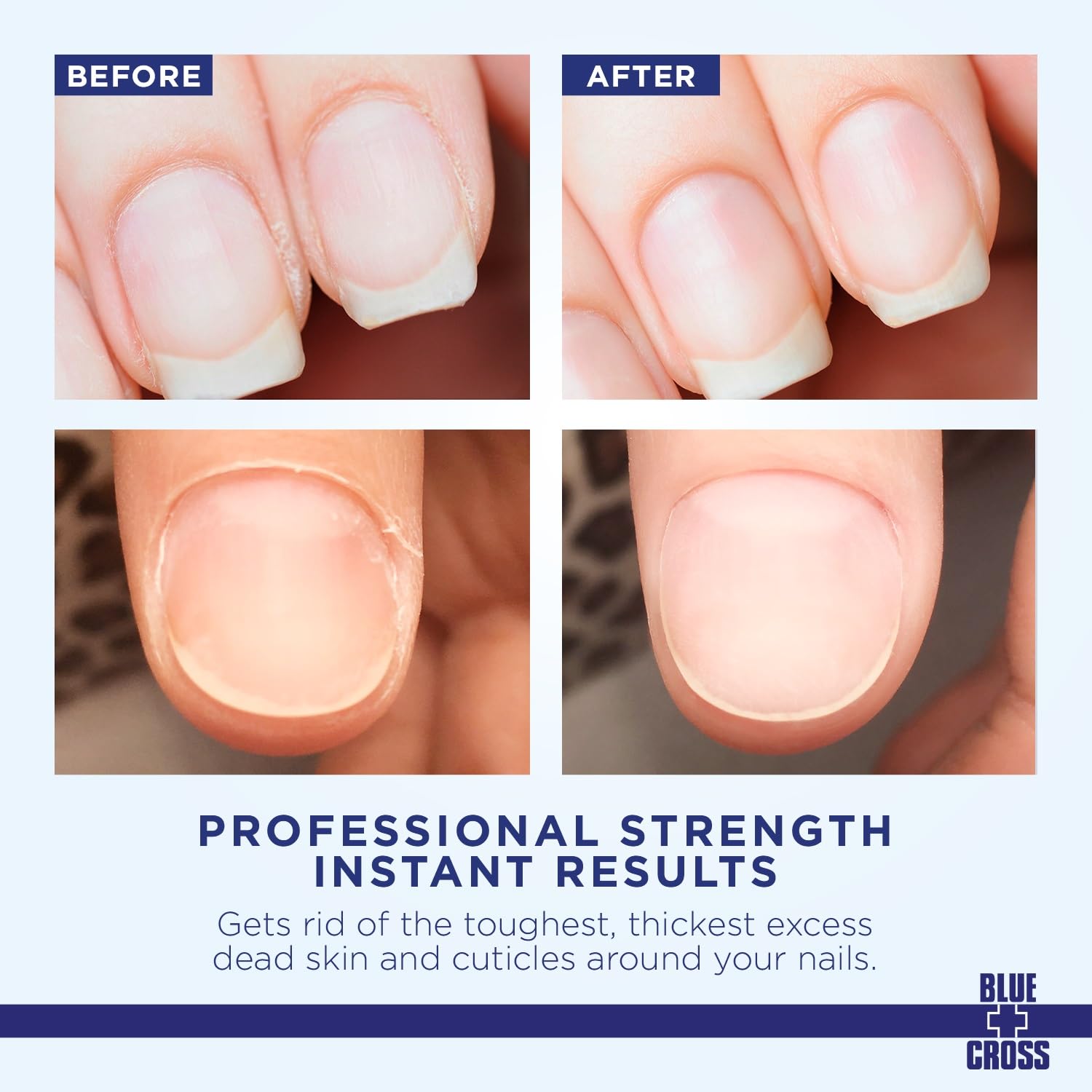 Universal Nail Supplies blue cross cuticle remover and softener liquid for nails, 8oz, in a clear bottle with a blue cap.