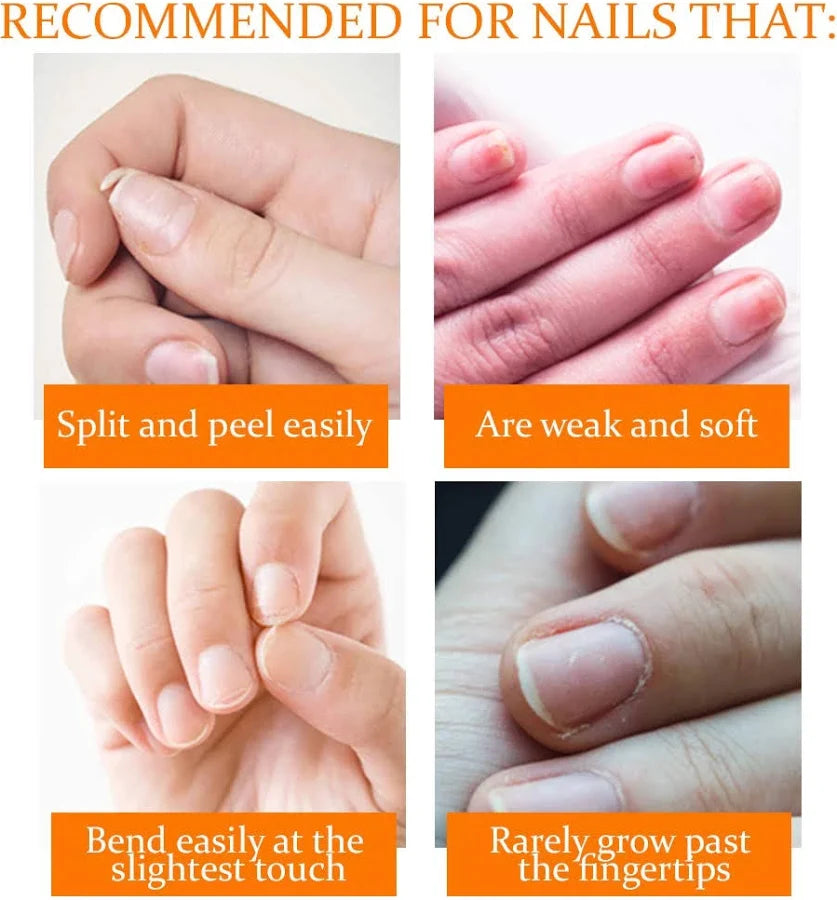 Nail Tek - Nail Recovery System Kit For Soft Peeling Nails